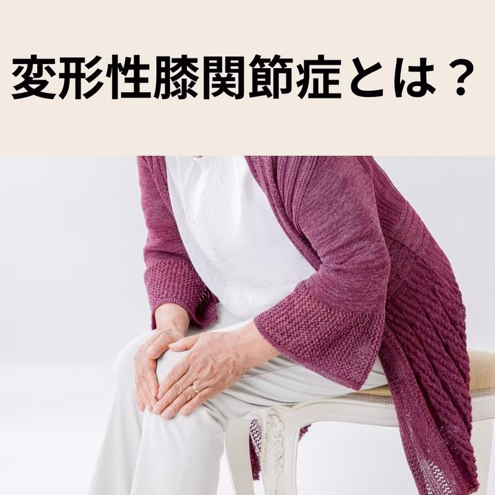 変形性膝関節症とは?進行度ごとの症状・対策や歩行を支える新しい選択肢