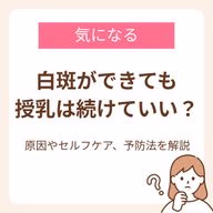白斑(はくはん)ができても授乳は続けていい?原因やセルフケア、予防法を解説