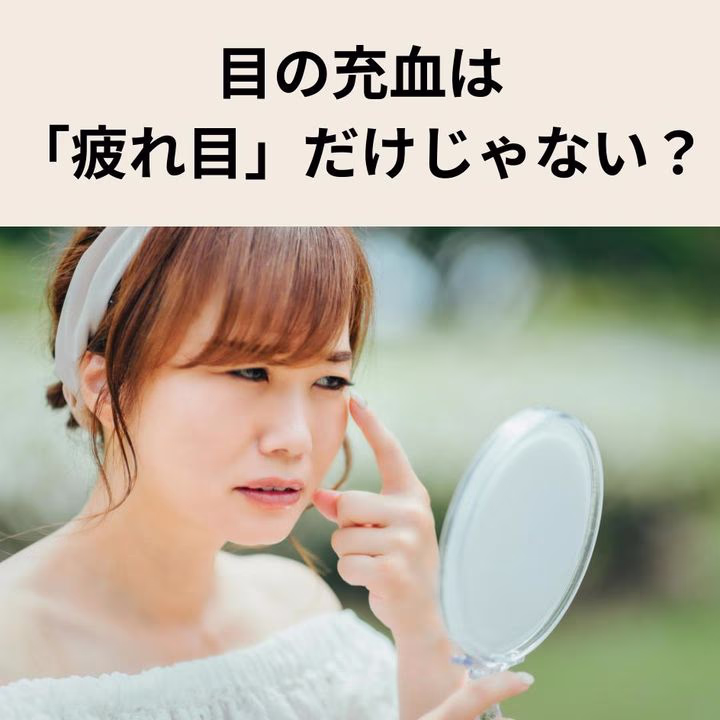 目の充血は「疲れ目」だけじゃない？放置NGの症状とは